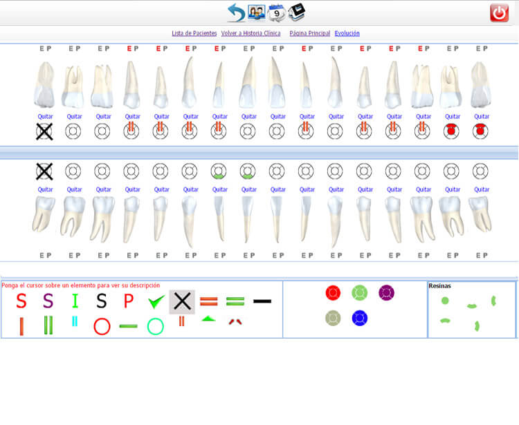 Odontograma online - Software dental online DentOS